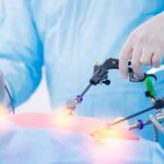 تقنيات جراحية جديدة في علاج بطانة الرحم: من vNOTES إلى الطب التجديدي